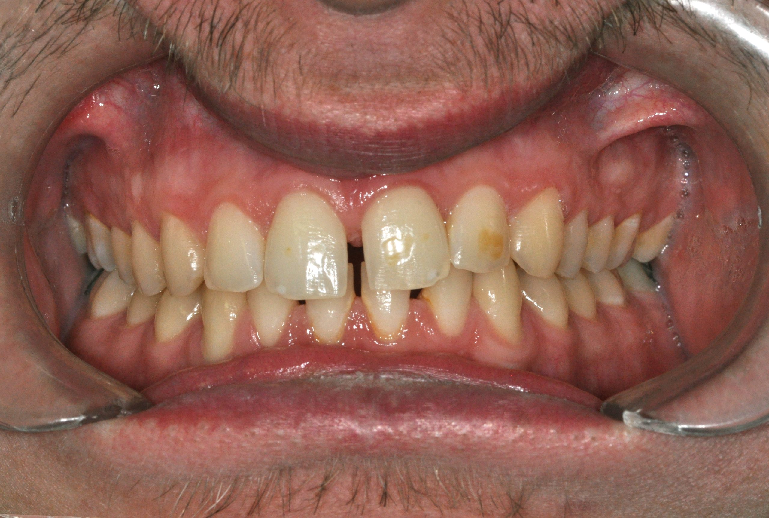 Before image alt