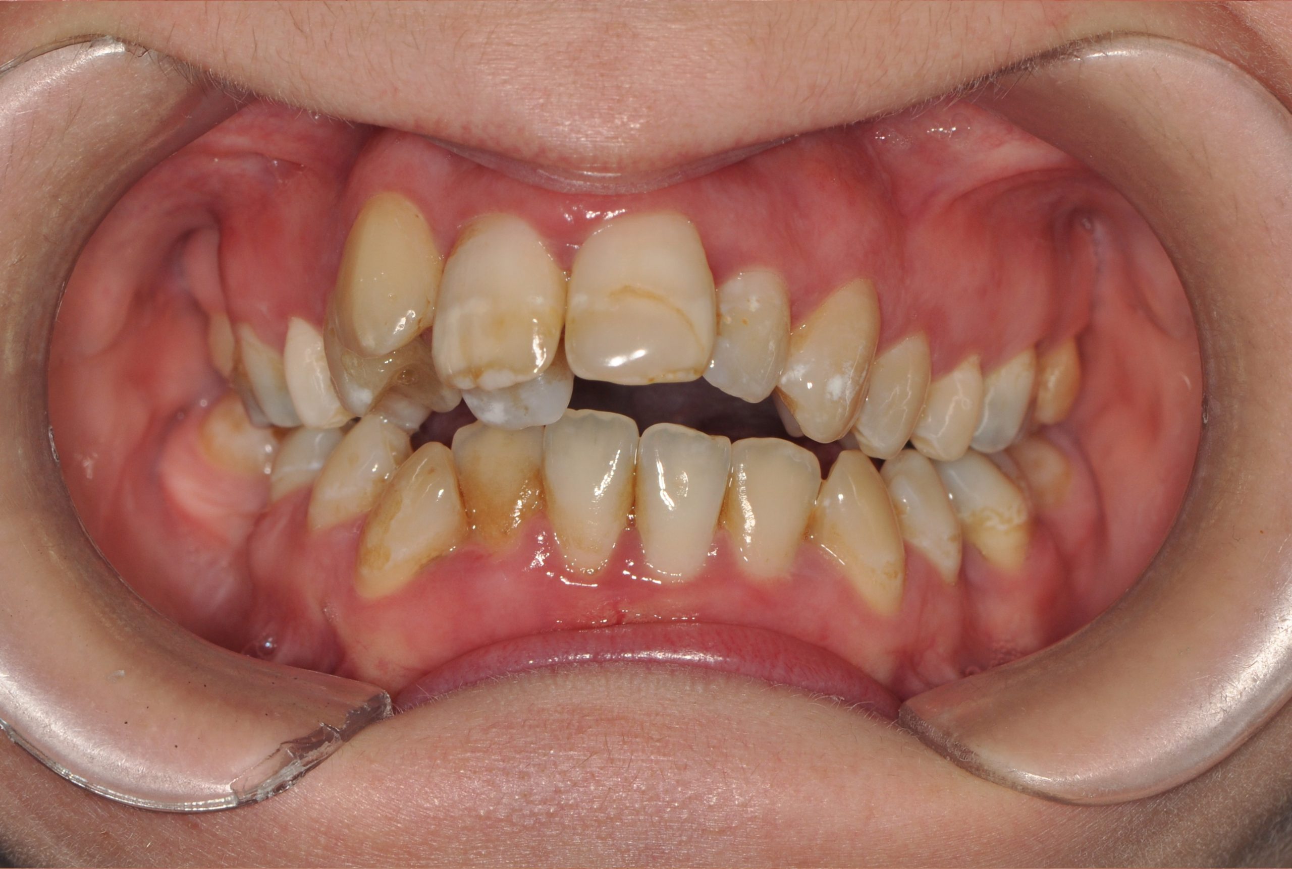 Before image alt