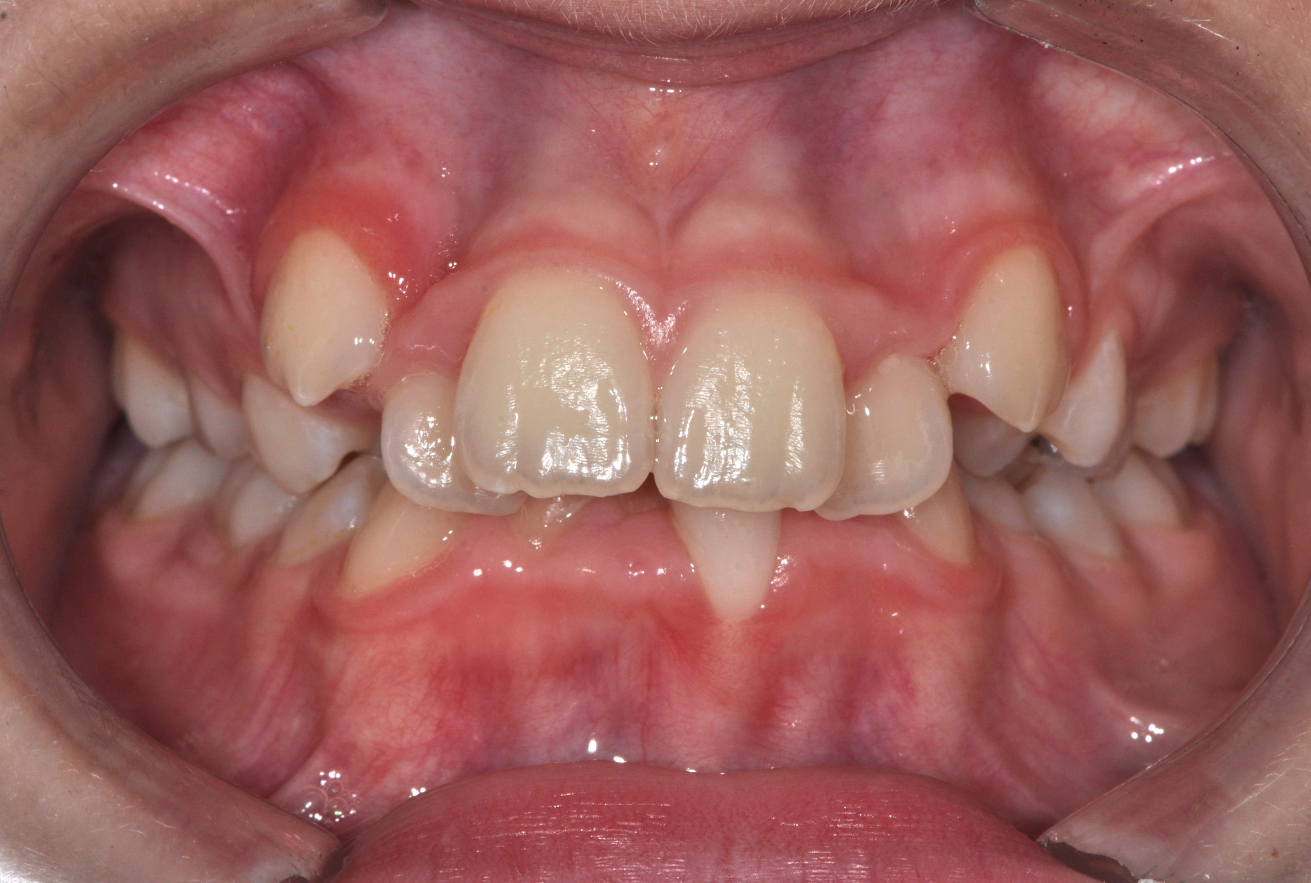 Before image alt