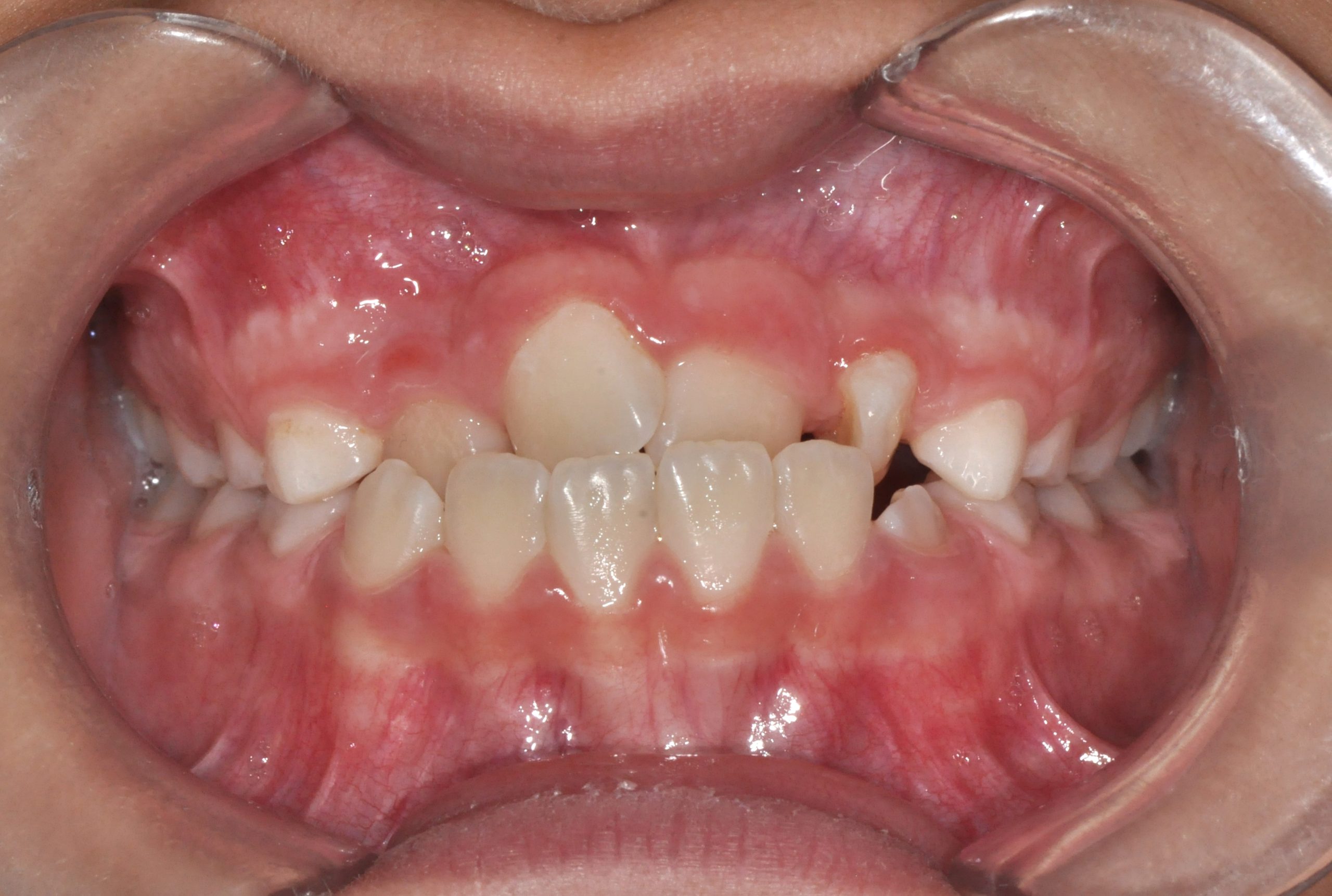 Before image alt