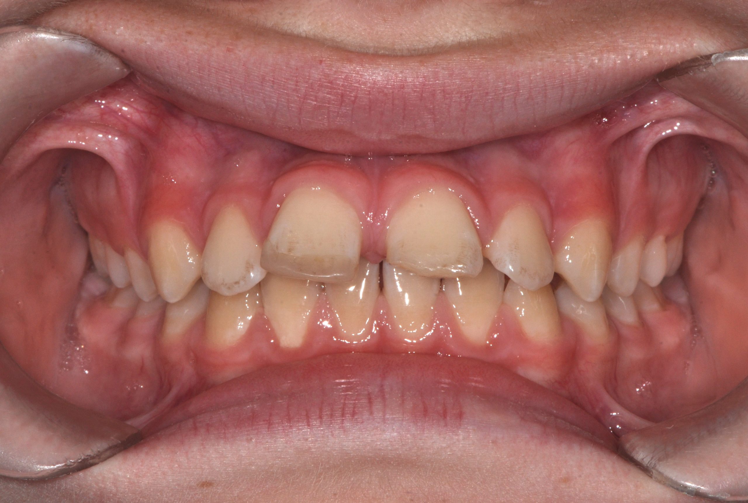 Before image alt