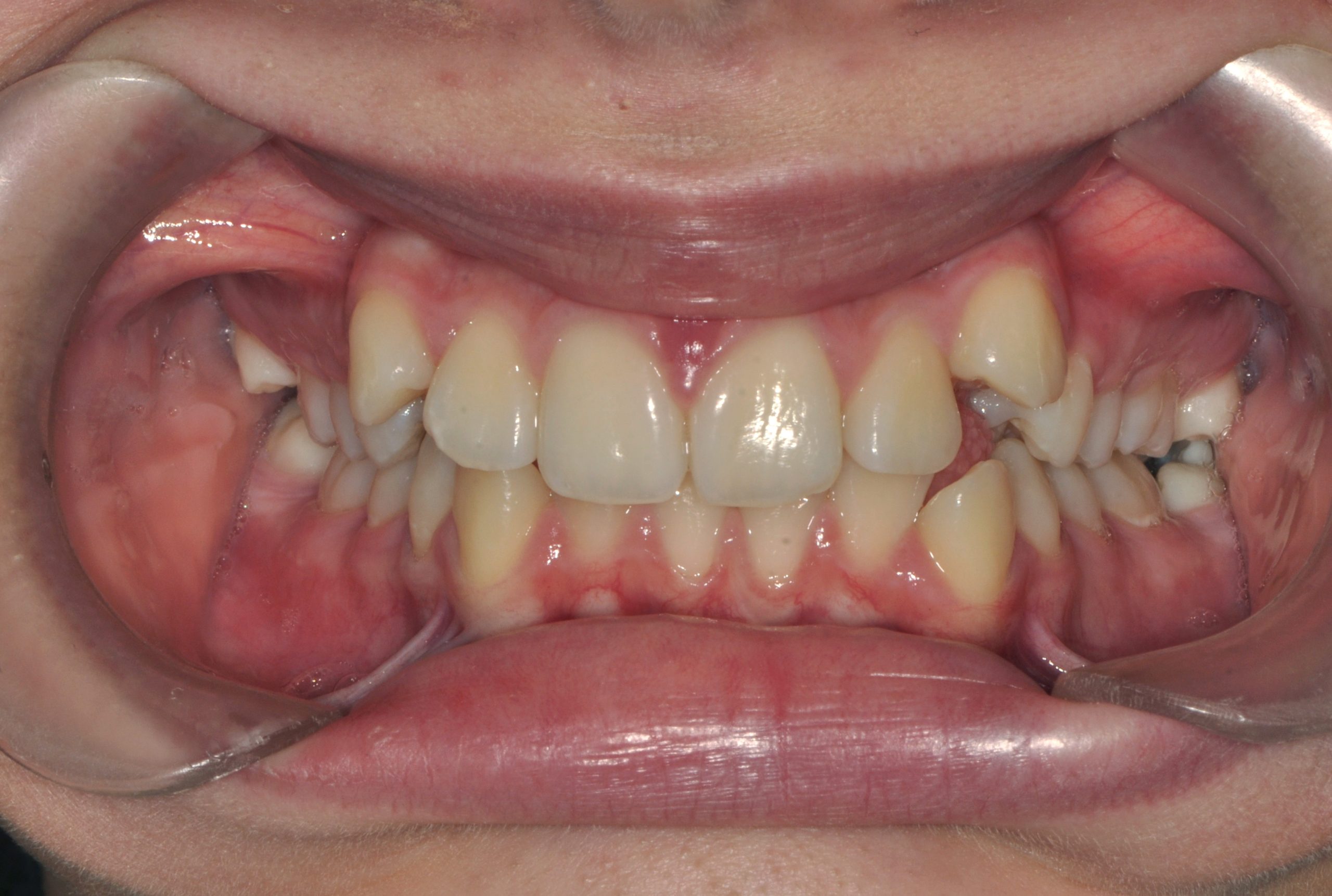 Before image alt