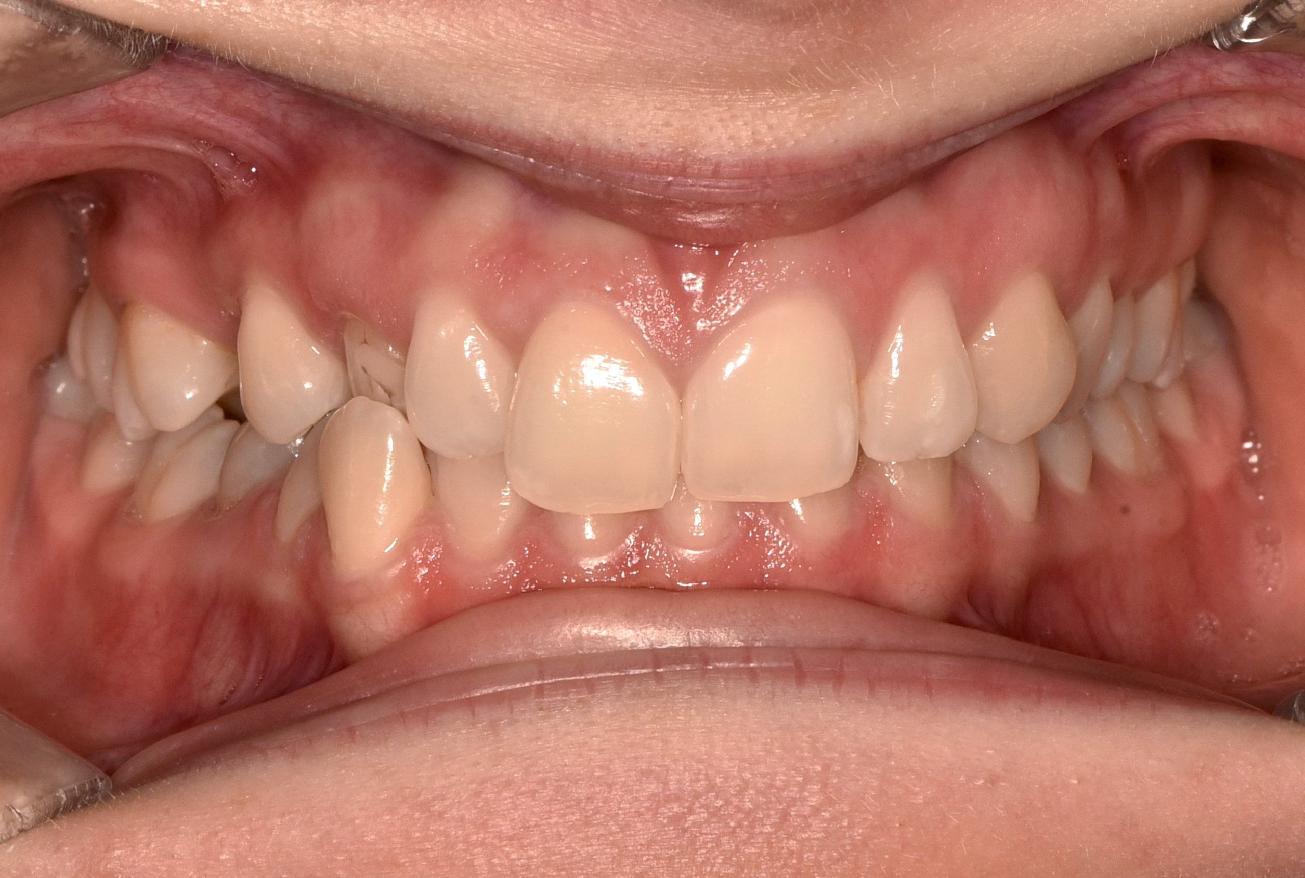 Before image alt