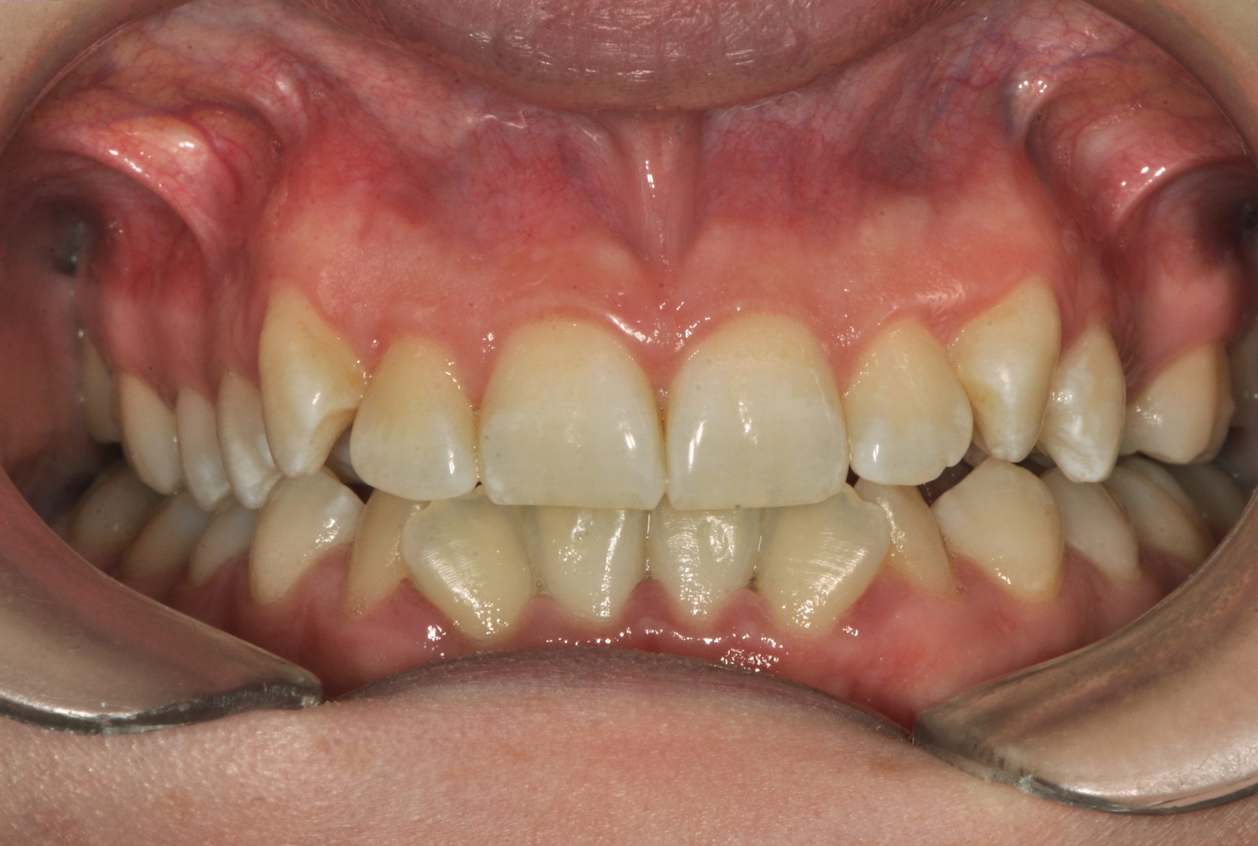 Before image alt