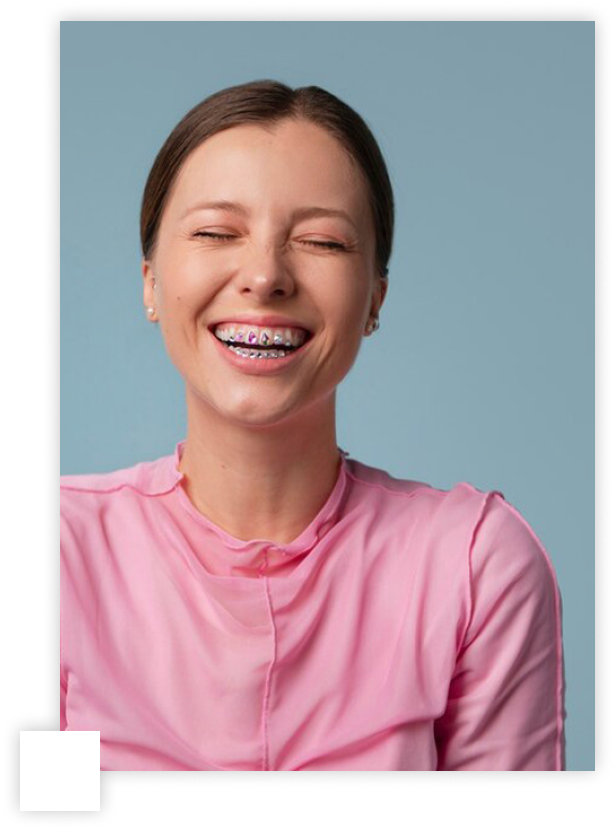 Élet fogszabályzóval – Gyakori problémák, megoldások