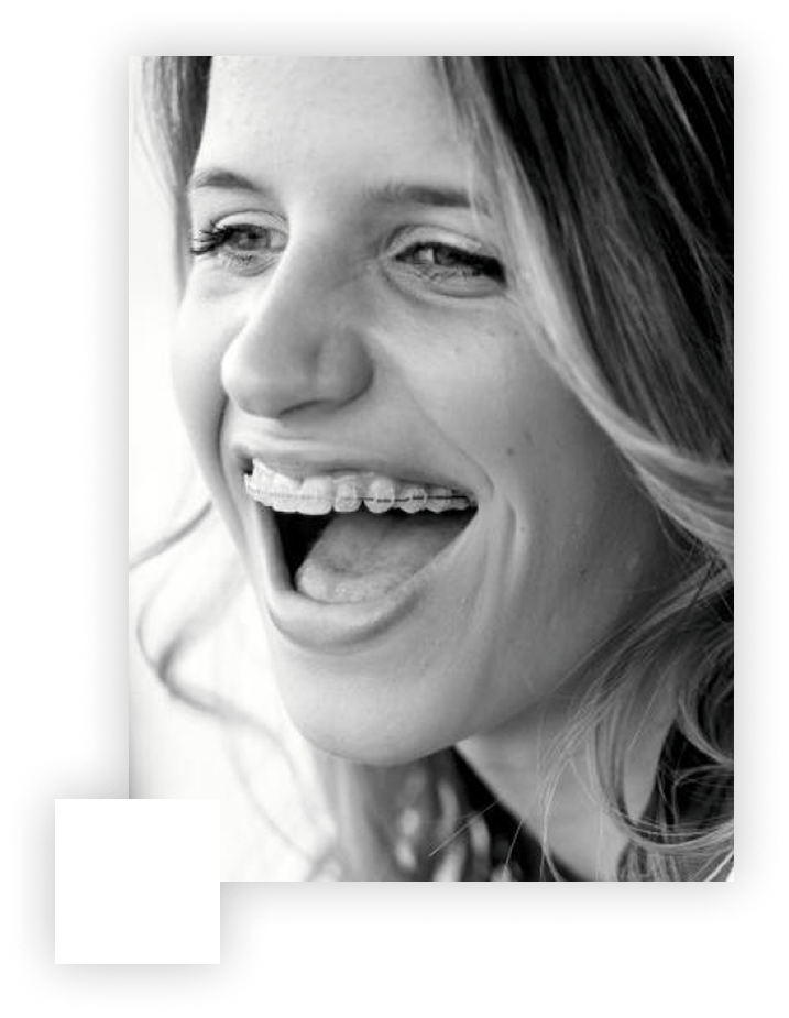 Felnőtt kori fogszabályozás